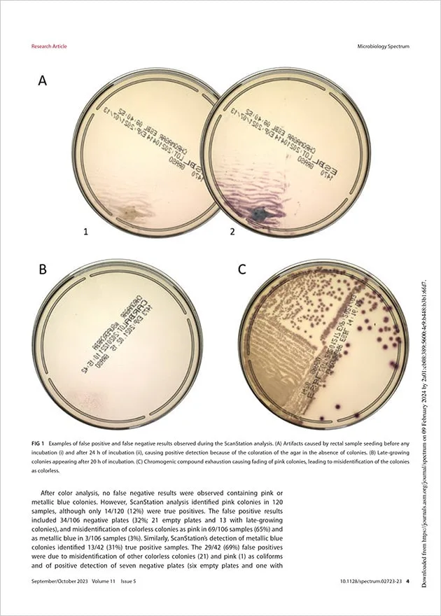 Detección rápida y automatizada de bacterias gramnegativas productoras de carbapenemasas y BLEE a partir de frotis rectales utilizando medios de agar cromogénico y el dispositivo ScanStation (en inglés)