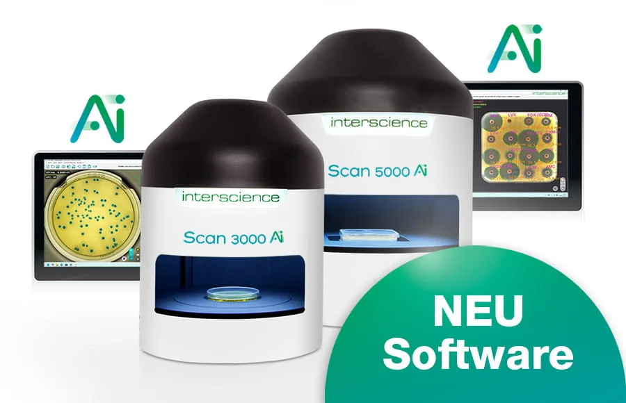 Scan Ai: Automatischer KI-Koloniezähler