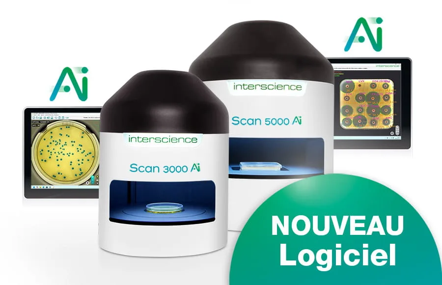 Scan Ai : Compteurs automatiques de colonies IA