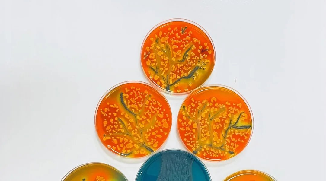 We support Agar'Art